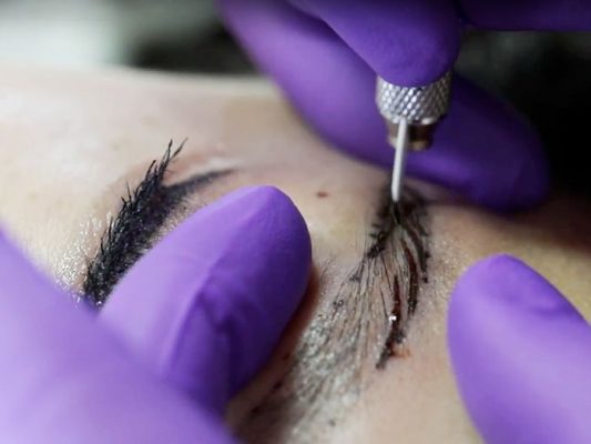 میکروشیدینگ یا میکروبلیدینگ