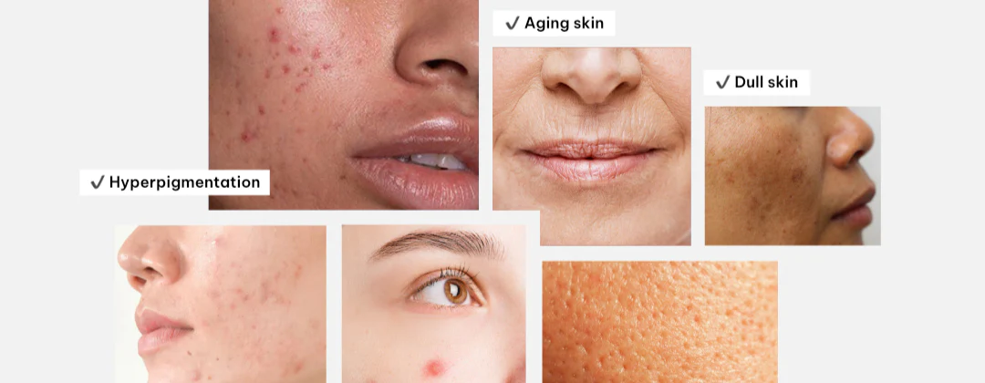 روتین ساز آرومیس