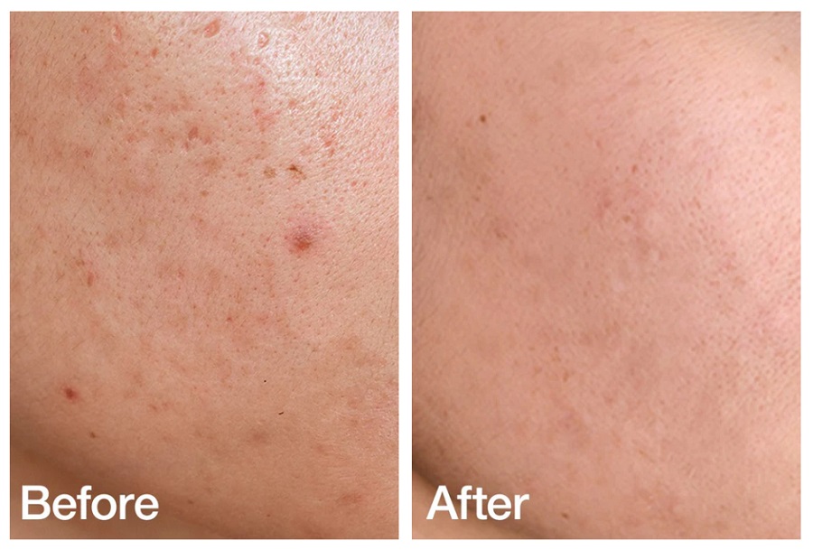 تونر تسکین دهنده آنوا