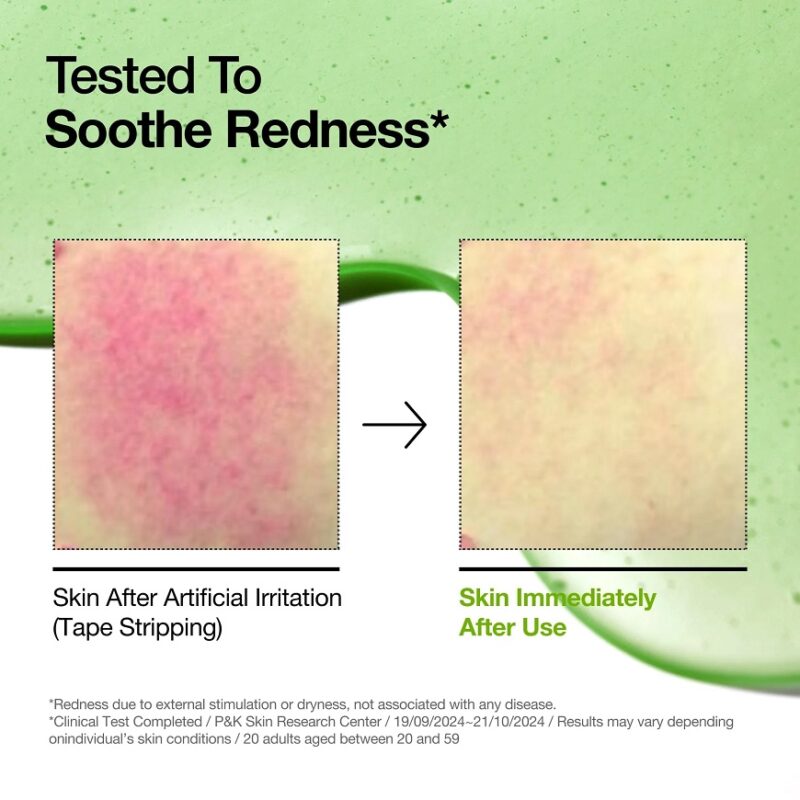 سرم آزلائیک اسید آنوا